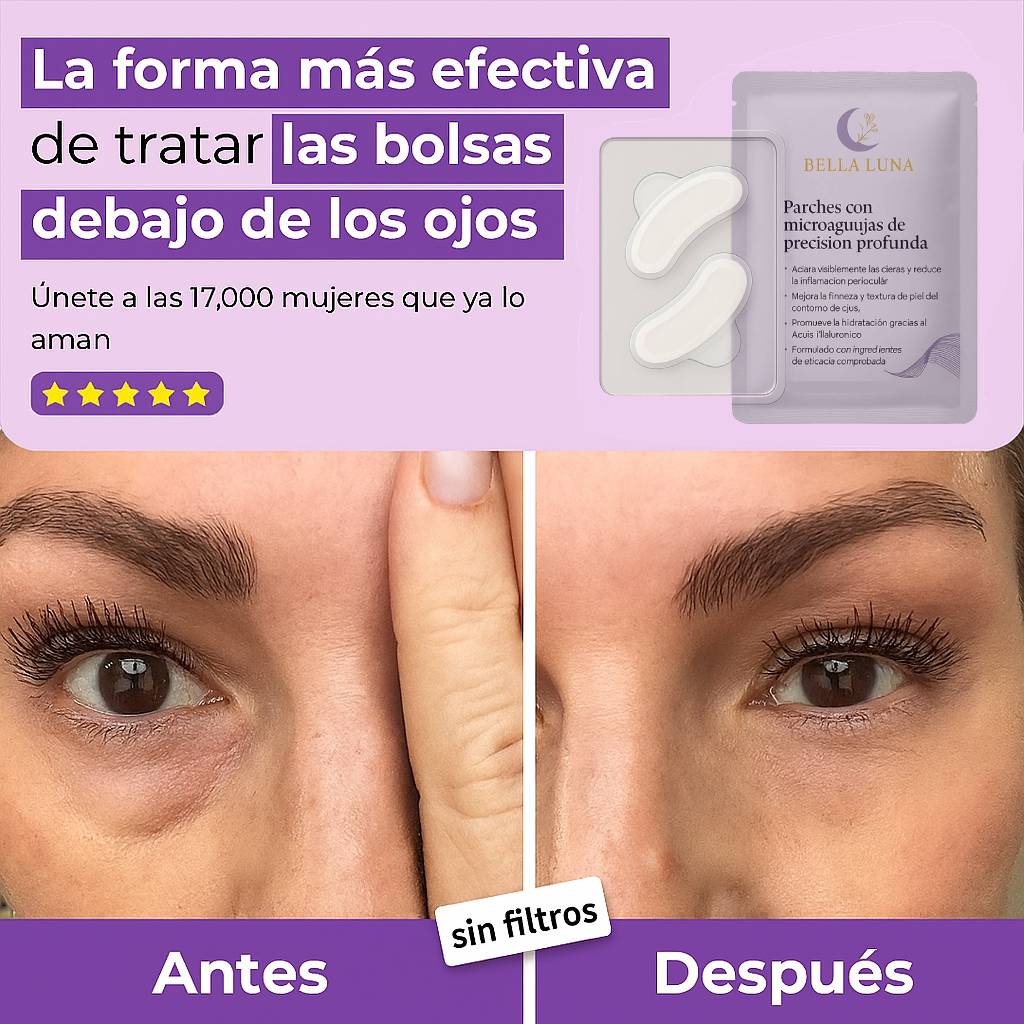 Parches de Microagujas + Ácido hialurónico para ojeras, bolsas y arrugas