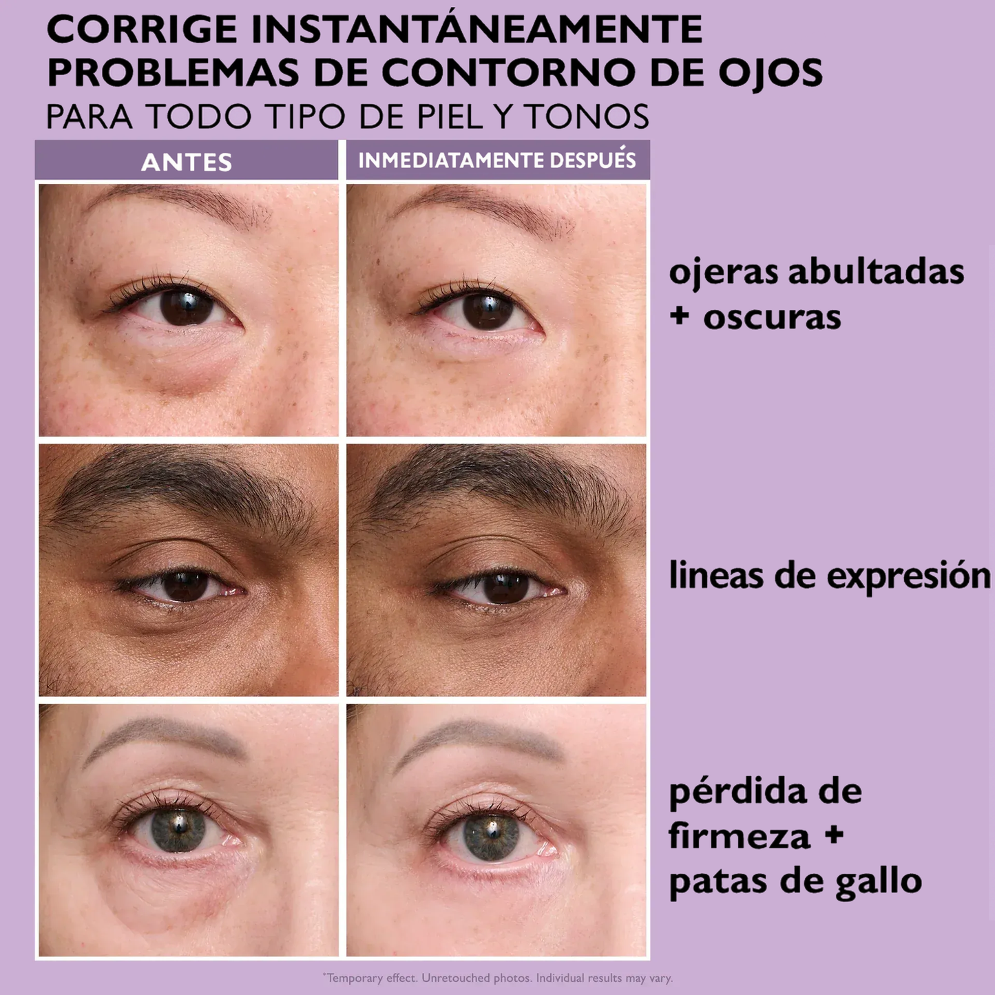 Crema Lifting Efecto Instantáneo | Repara arrugas, ojeras y flacidez