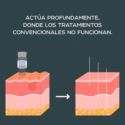 Microinfusión Antiedad Ceralyne