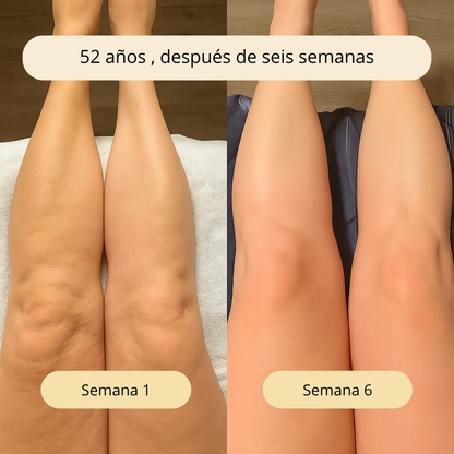 Aceite Anti-Celulitis: Resultados visibles en solo 7 días