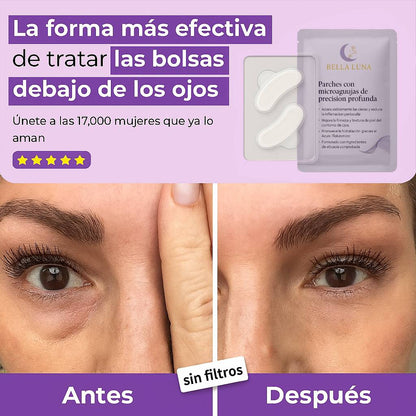 Parches de Microagujas + Ácido hialurónico para ojeras, bolsas y arrugas